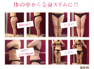 sp_slimming_img012